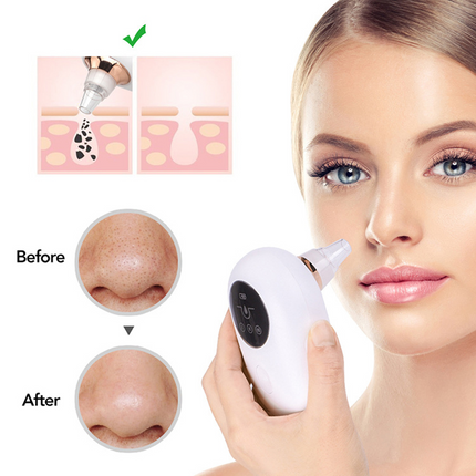 Portable Vacuum Blackhead Remover