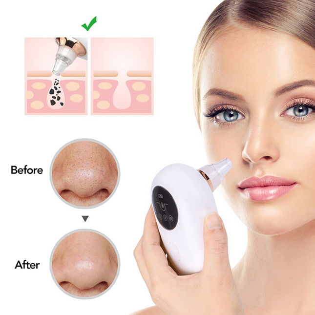 Portable Vacuum Blackhead Remover
